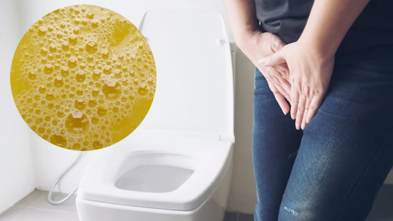 FOAMY URINE