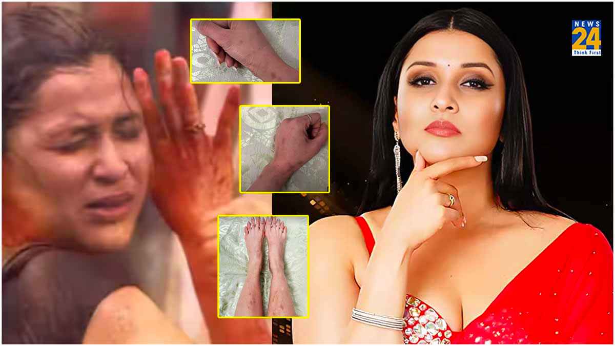 Mannara Chopra Scars