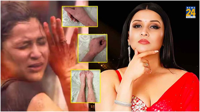 Mannara Chopra Scars