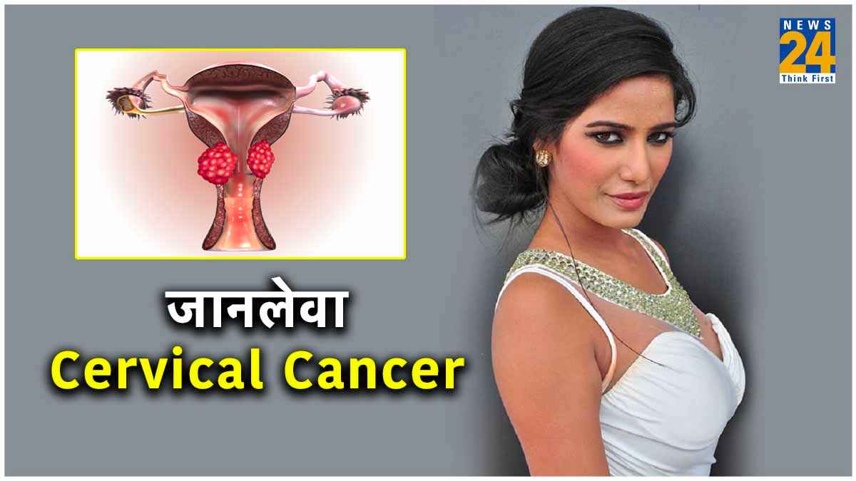 पूनम पांडे ही नहीं हर रोज 900 से ज्‍यादा मह‍िलाओं की मौत, डरा देंगे सर्वाइकल कैंसर के ये नंबर