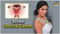 Poonam Pandey Cervical Cancer