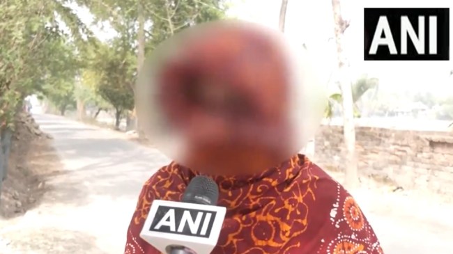 Sandeshkhali-Violence-victim Sandeshkhali Violence victim