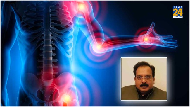 Arthritis treatment Arthritis treatment