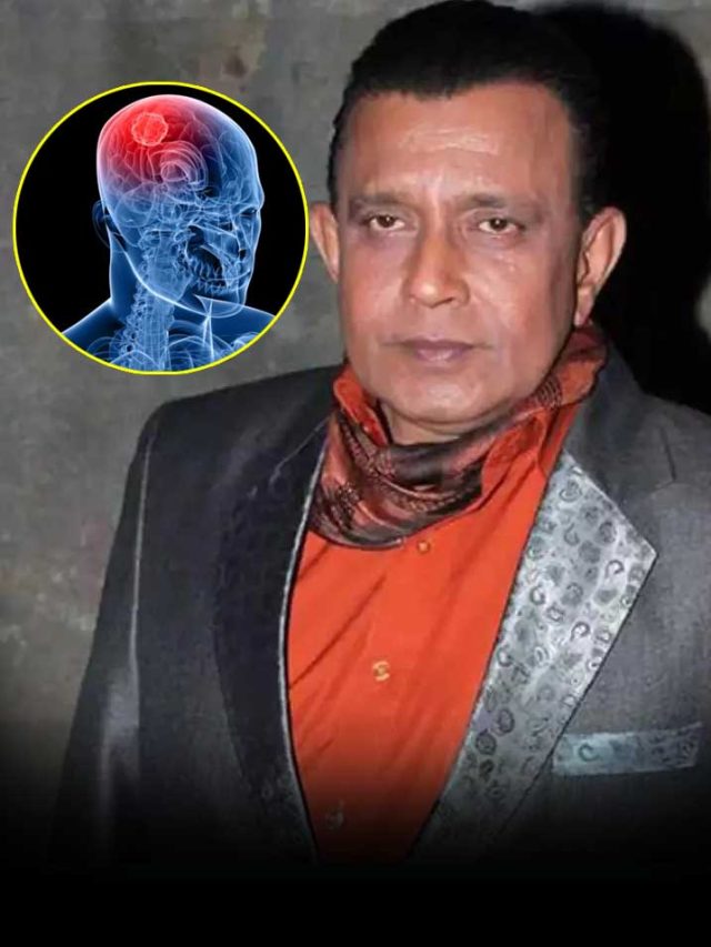 brain-stroke-8-news24-hindi