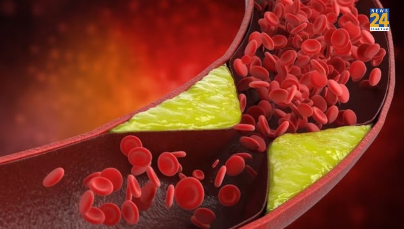 Cholesterol