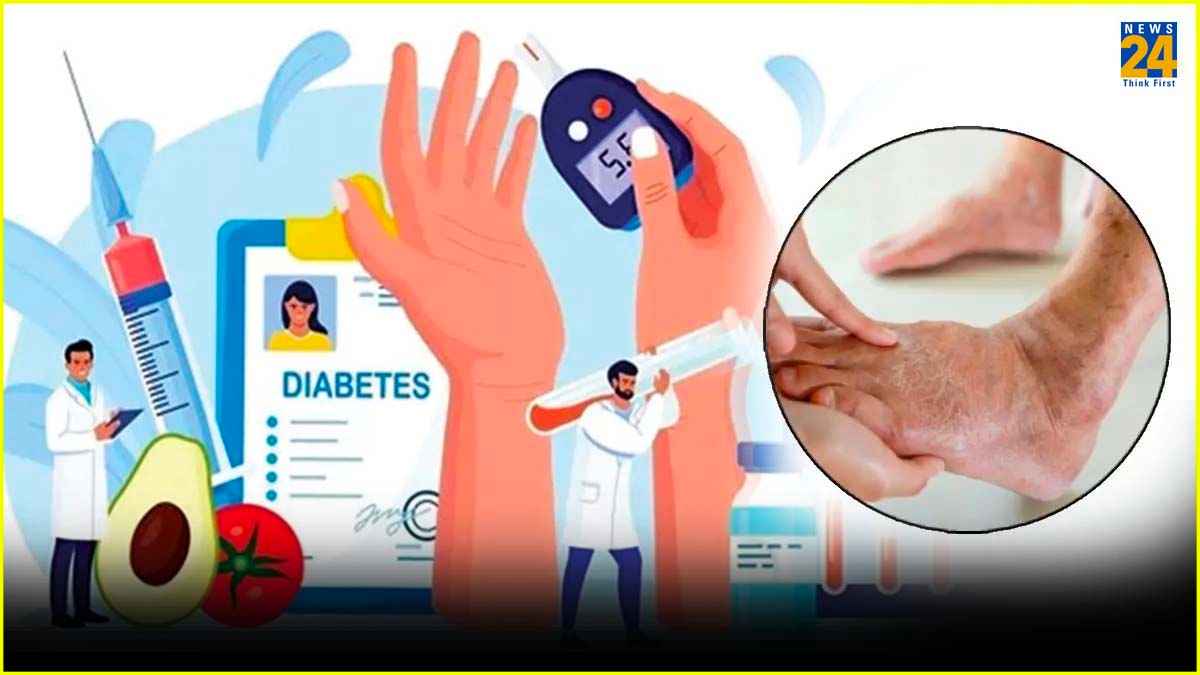 Diabetes से हर तीसरा व्यक्ति है पीड़ित! जानें बचाव, लक्षण से लेकर सब कुछ