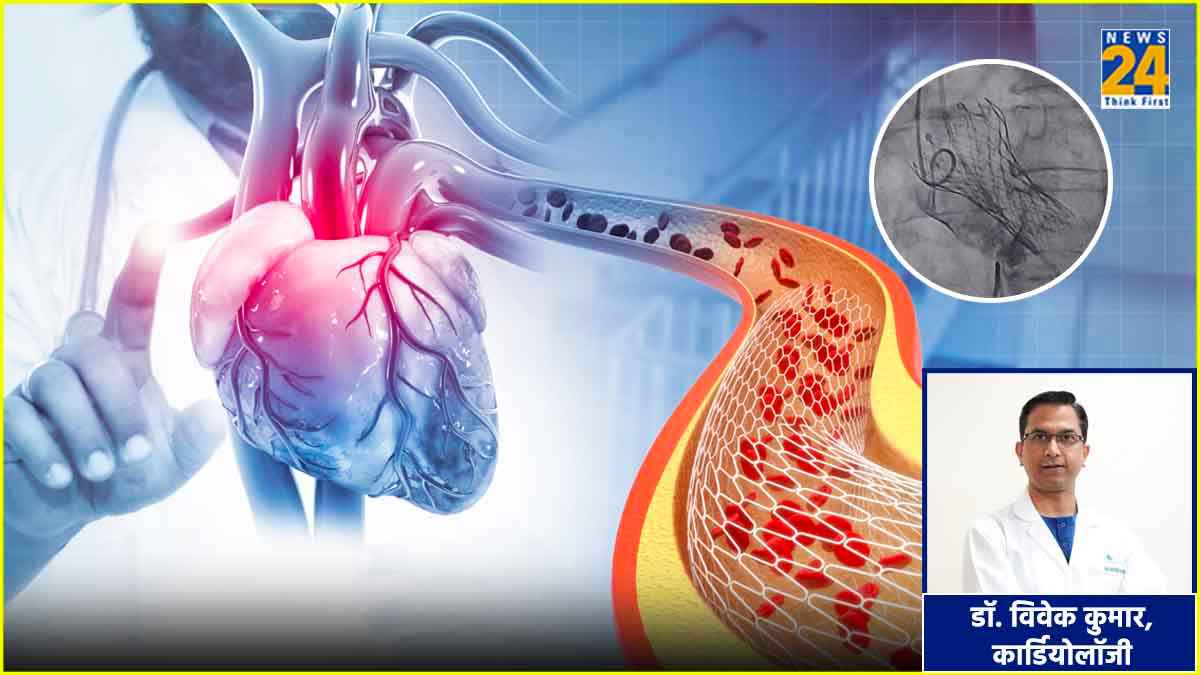Heart Stent Surgery (1)
