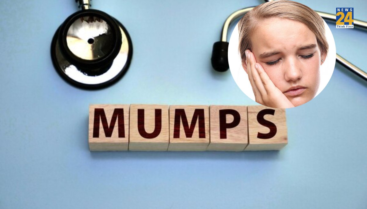 Mumps Outbreak