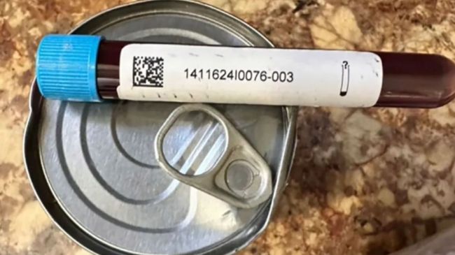 Woman ordered clothes found vial full of blood