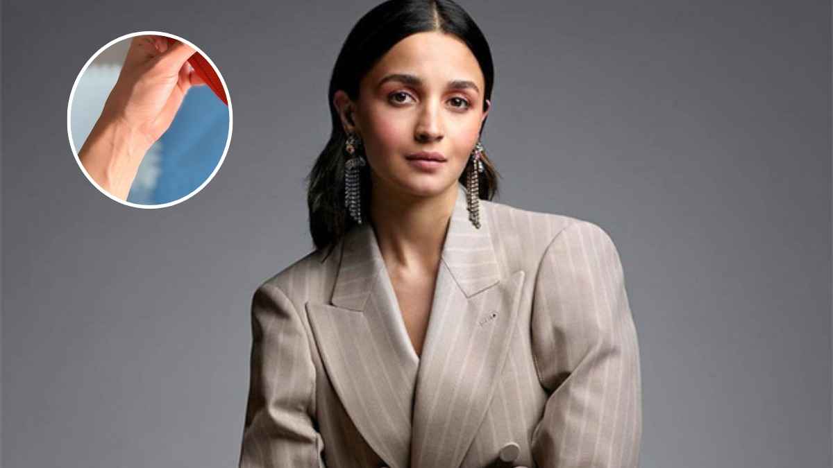 Alia Bhatt Wrist Scar
