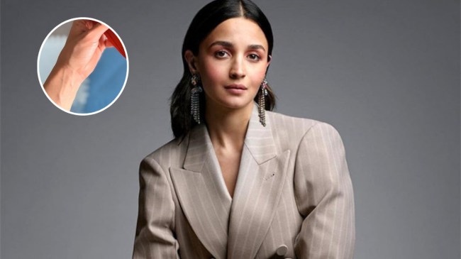 Alia Bhatt Wrist Scar