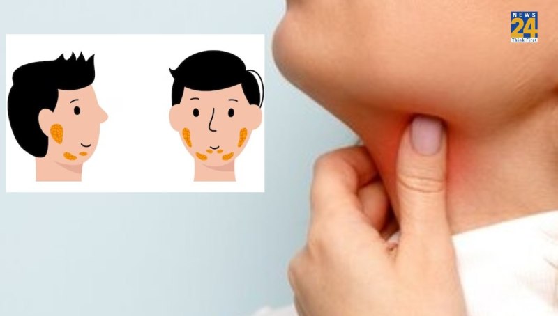 mumps symptoms