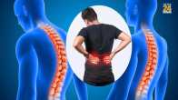BACK PAIN CAUSES