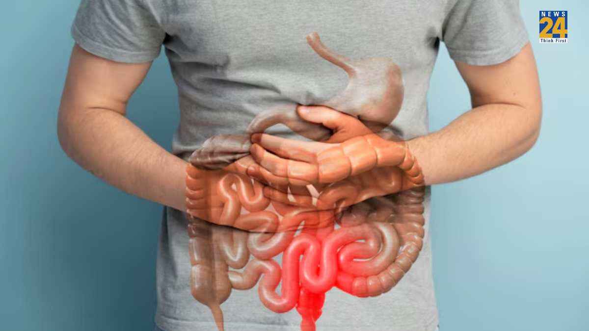 Constipation Relieving foods Constipation Relieving foods