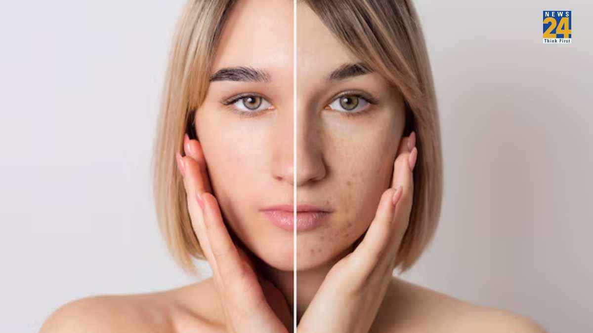 Home Remedies For Open Pores: चेहरे पर दिख रहे हैं ओपन पोर्स तो अपनाकर देखें रसोई के ये 5 घरेलू नुस्खे
