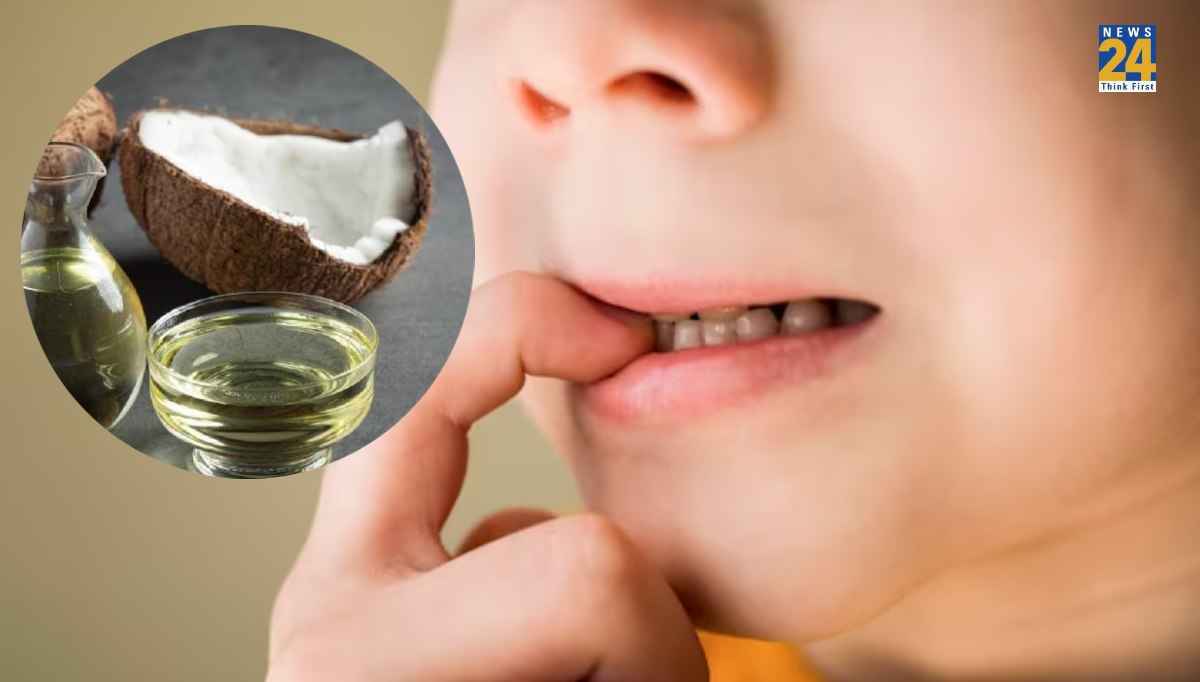 Mouth Ulcers Home Remedy