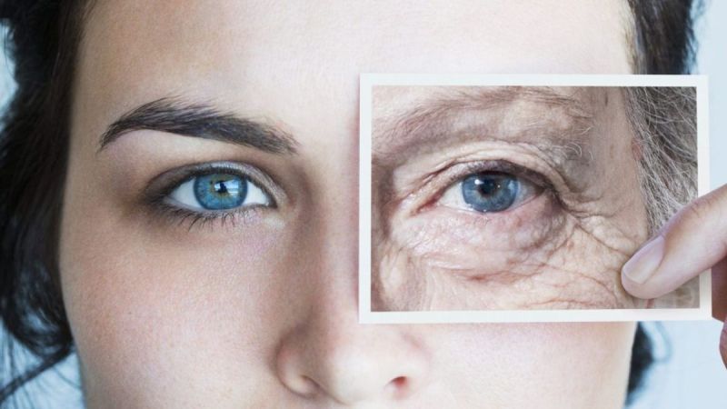 Ageing