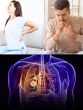 Lung Cancer