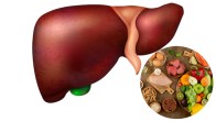 fatty liver diet