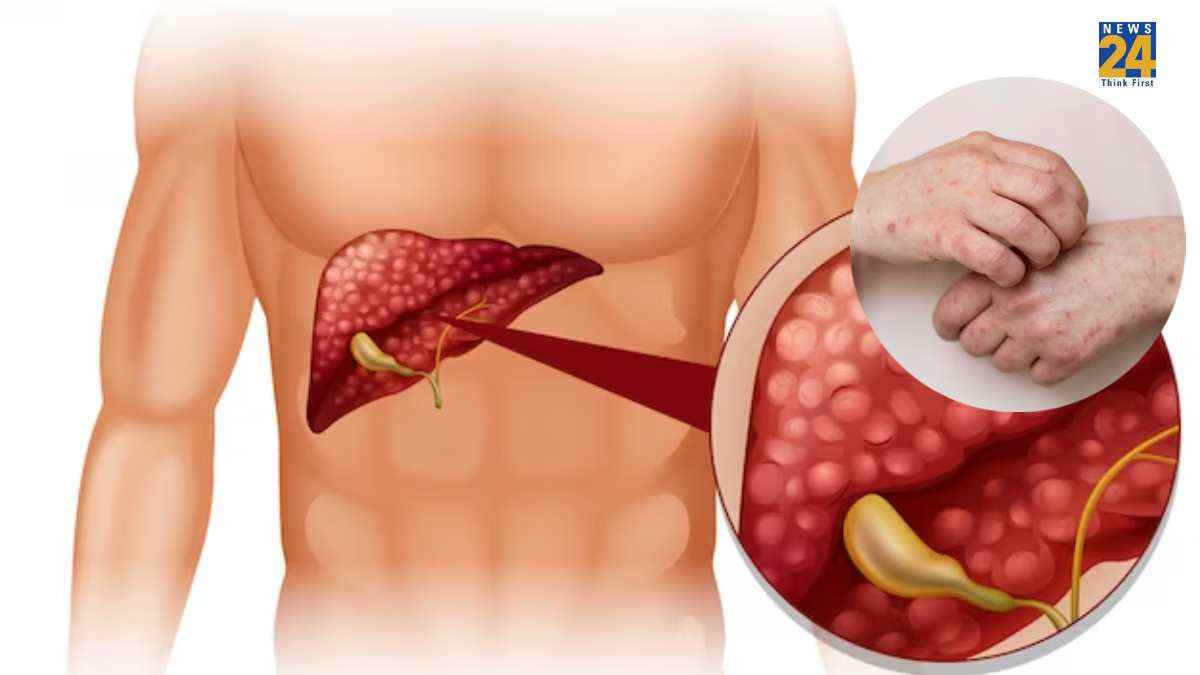 Liver Failure होने पर दिखते हैं ये 7 शुरुआती लक्षण, बिल्कुल न करें इग्नोर