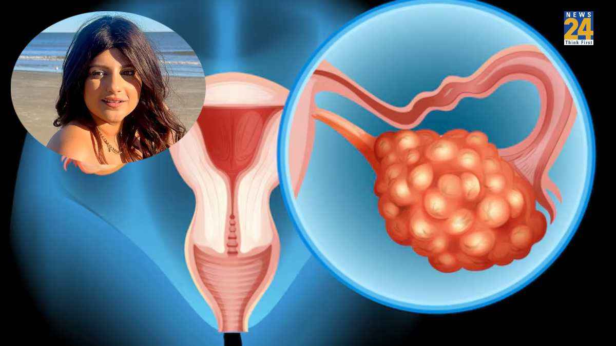 ovarian cancer symptoms