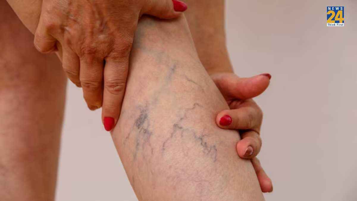 Home Remedies: ब्लॉक नसों को खोलेंगे ये 5 घरेलू उपाय