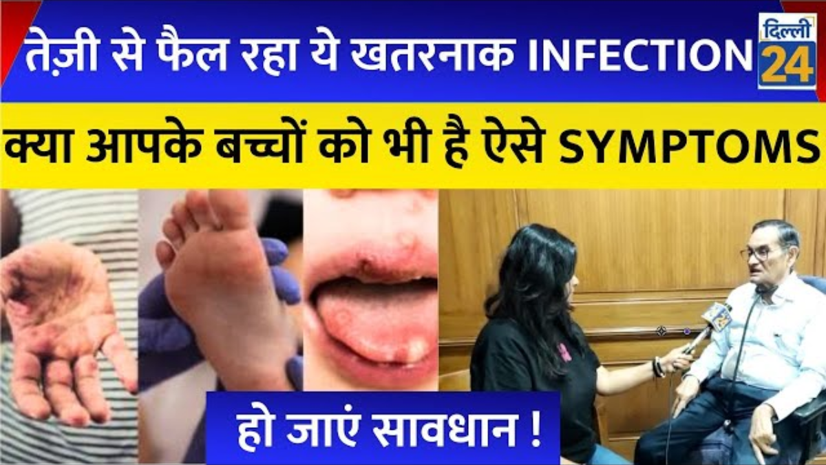 बढ़ती गर्मी में तेजी से फैल रहा Infection, आपके बच्चों में भी दिख रहे