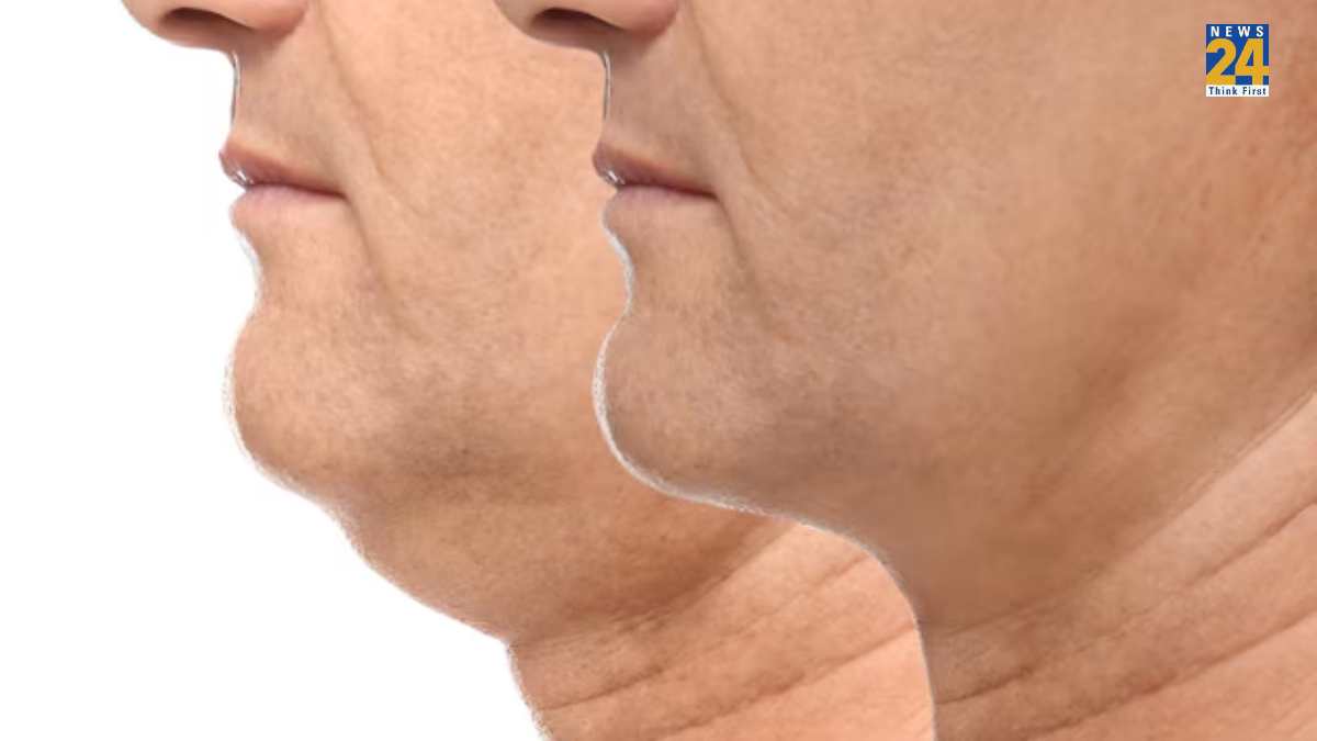 How To Get Rid Off Double Chin