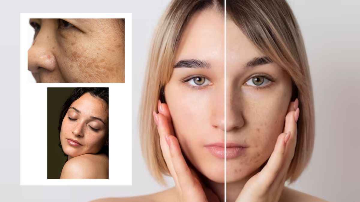 Pigmentation: दाग-धब्बे की समस्या में चेहरे पर 3 चीजों को लगाना हो सकता है नुकसानदायक