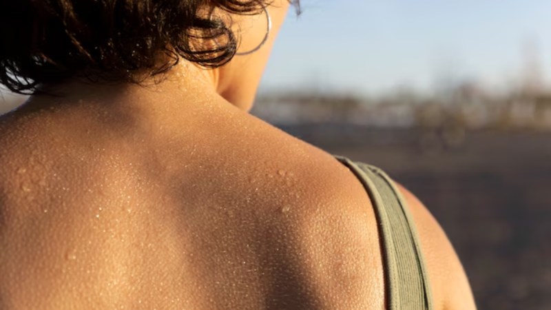 Sunburn And Tanning Difference