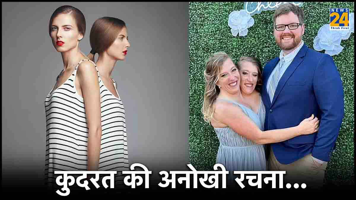 Conjoined Twin Sisters Shared One Vagina Private Part Homosexual Lesbian