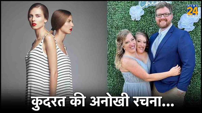 Conjoined Twin Sisters Shared One Vagina Private Part Homosexual Lesbian