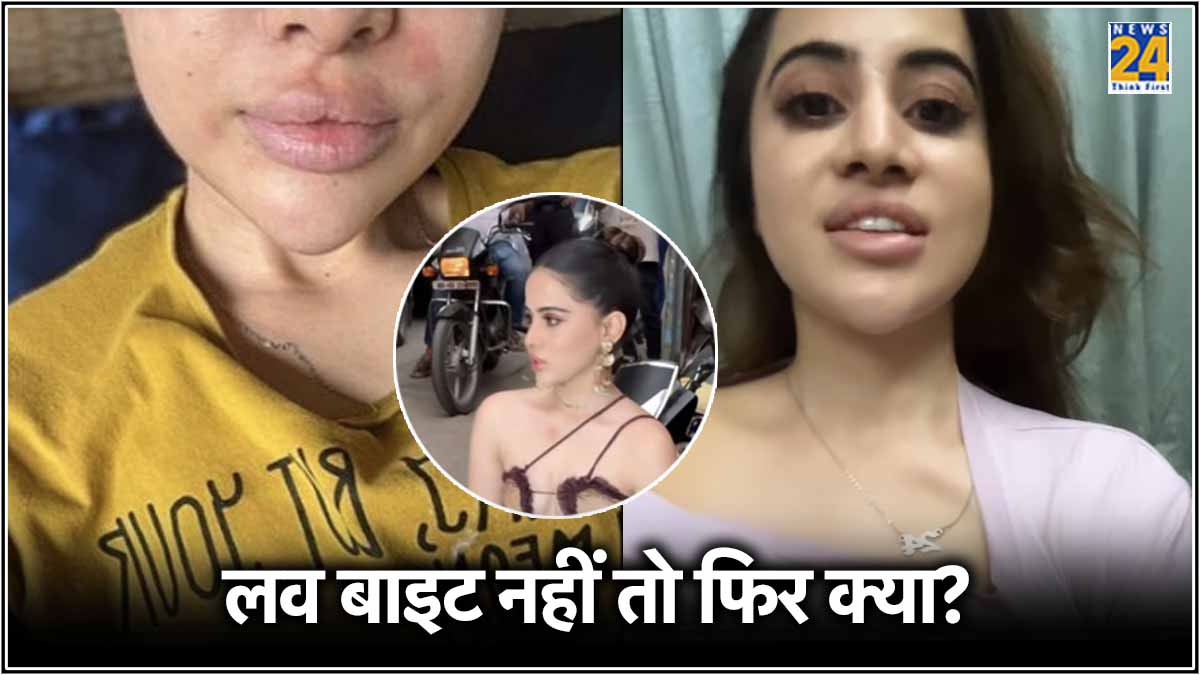 सीने पर लव बाइट या कुछ और? Urfi Javed ने खुद कैमरे के सामने टी-शर्ट ...