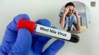 West Nile Virus symptoms