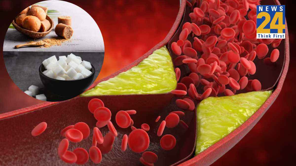 cholesterol problems