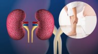 kidney damage signs