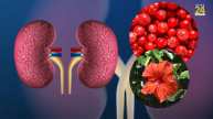 kidney disease problems