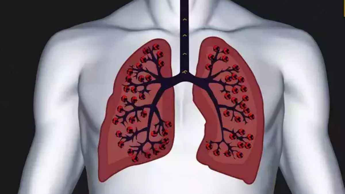 क्या आपके फेफड़े मजबूत हैं? इन 5 तरीकों से करें पहचान