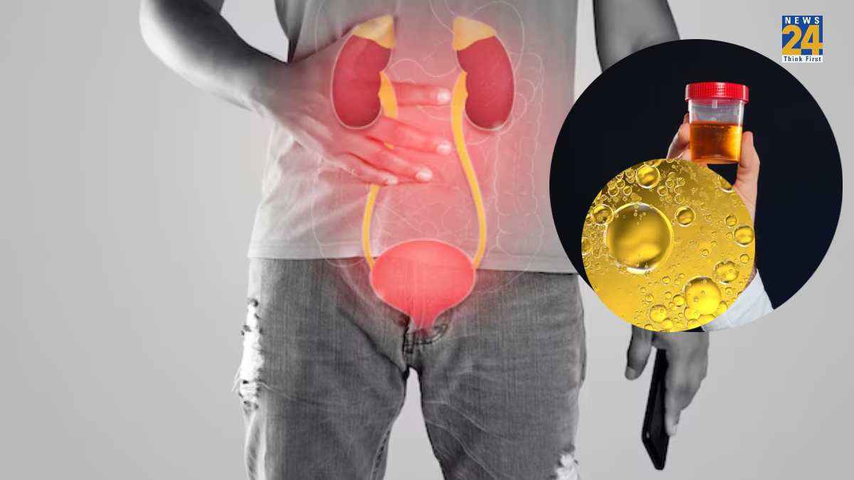 protein in urine