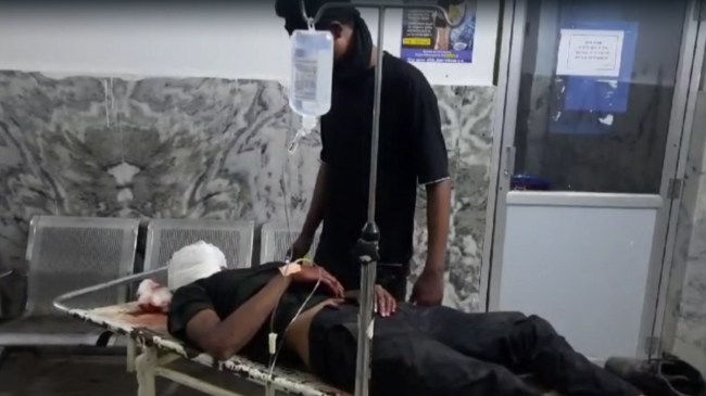 AC Blast Mechanic Injured Brutally in Chhattisgarh Civil Hospital AC Blast Mechanic Injured Brutally in Chhattisgarh Civil Hospital