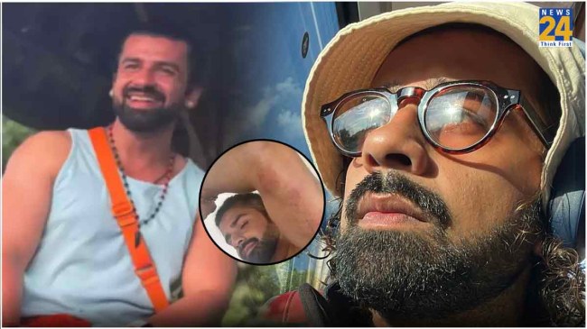 Aashish Mehrotra Injured