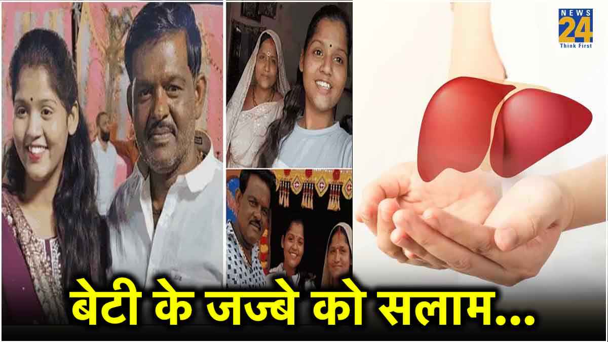 Liver Donation