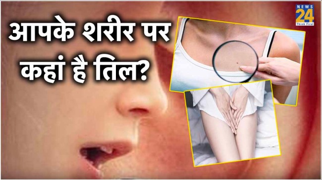 Meaning of Moles on Different Body Parts