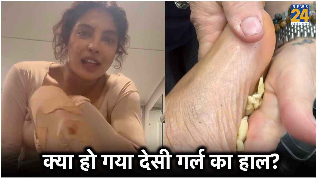 Priyanka Chopra Home Remedies