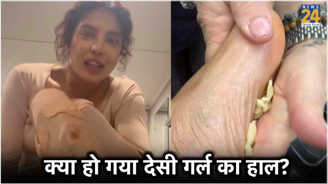 Priyanka Chopra Home Remedies