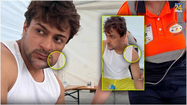 Shalin Bhanot Injured