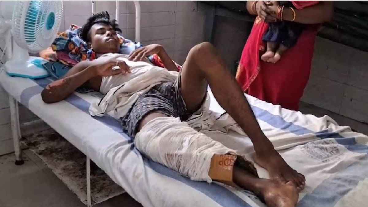 bihar cardboard fracture