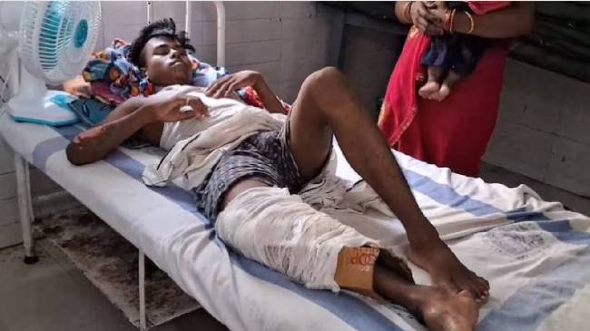 bihar cardboard fracture