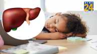 fatty liver problems in childrens