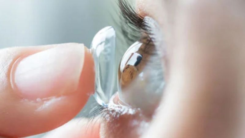 Acanthamoeba keratitis